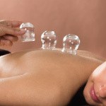 A woman receiving cupping therapy.