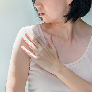 A woman applying sunscreen to prevent sunspots and burns.